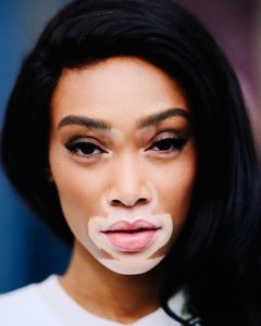 Winnie Harlow 