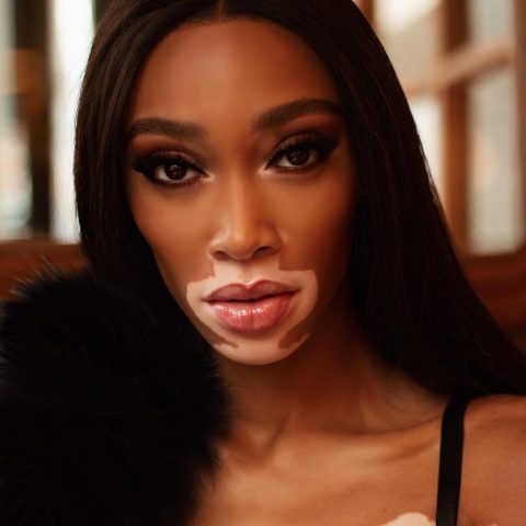 Beauty With A Cause: Winnie Harlow And MAC Team Up To Fight AIDS